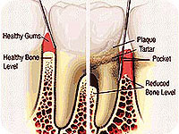 Best root canal & laser Specialist in Bhopal